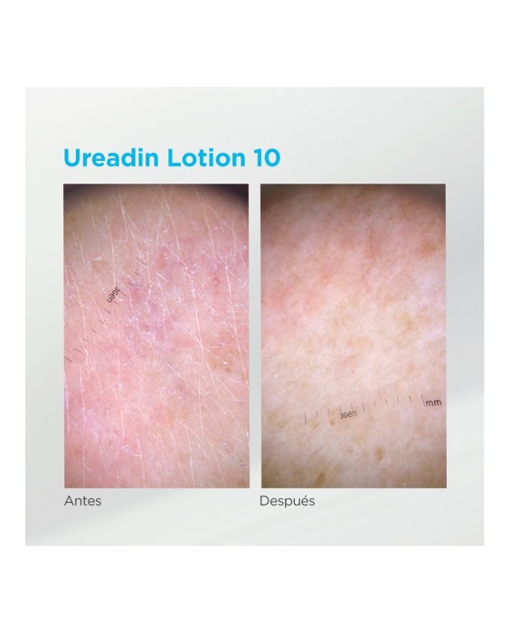 Isdin Ureadin Lotion 10 100мл Увлажняющий крем