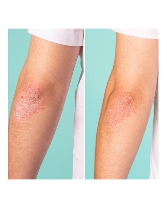 Bálsamo Vegan Hero All Purpose Balm 40 ml Freshly Cosmetics