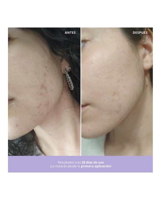 Crema Gel Azelaic Radiance Face Treatment  50 ml Freshly Cosmetics