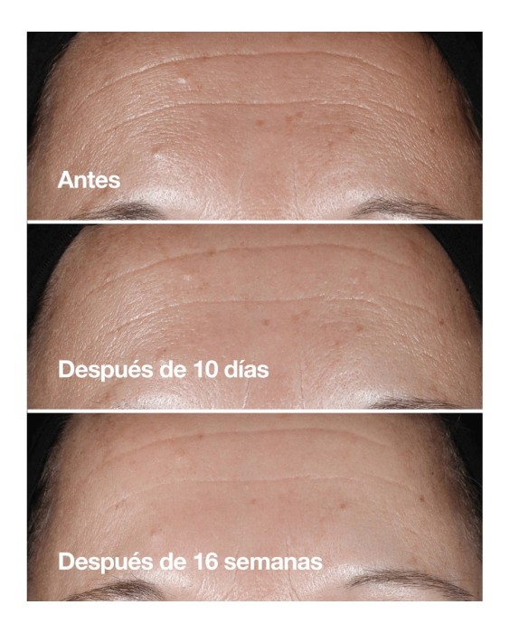 Sérum antiedad Smart Clinical Repair 75ml Clinique