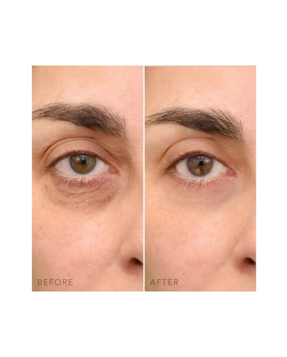 IRIS™ C-Concentrated Crema Iluminadora de Ojos FOREO