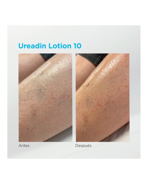 Lotion Hidratación Intensa Piel seca Ureadin 10 Isdin