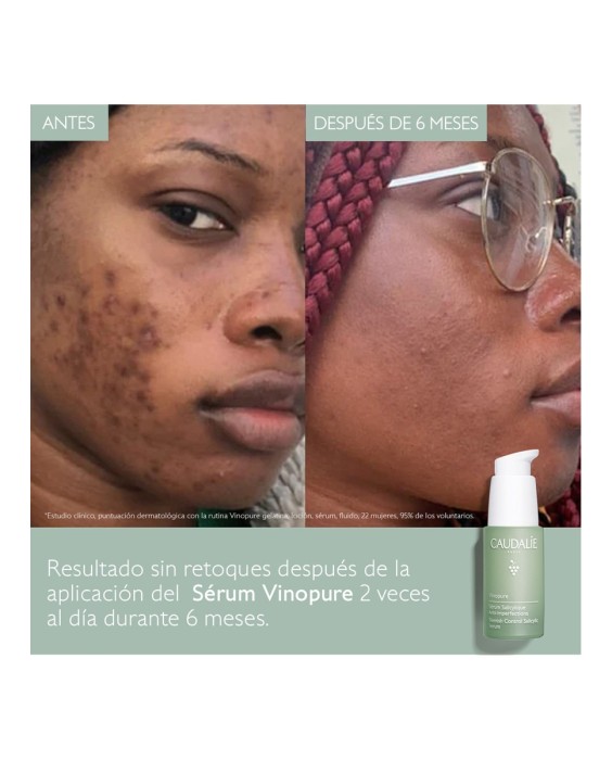 Sérum Anti-imperfecciones Vinopure 30 ml Caudalie