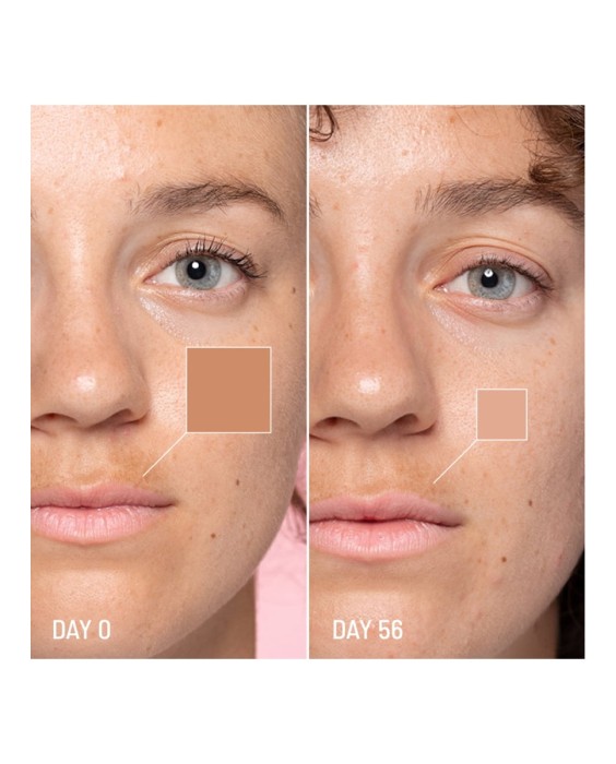 Tratamiento despigmentante Lotus Radiance Darkspot Treatment 50 ml Freshly Cosmetics