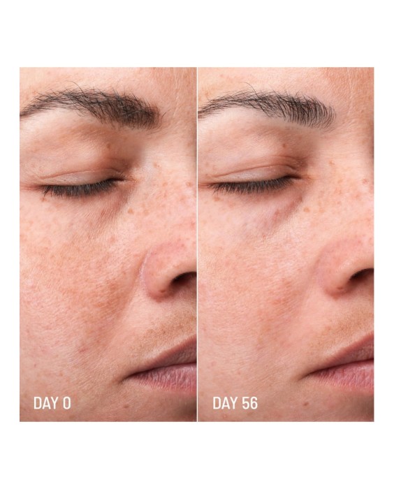 Tratamiento despigmentante Lotus Radiance Darkspot Treatment 50 ml Freshly Cosmetics