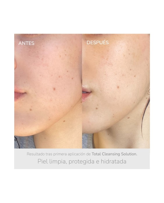 Gel limpiador purificante Total Cleansing Solution 100 ml NIEVES by Nieves Álvarez