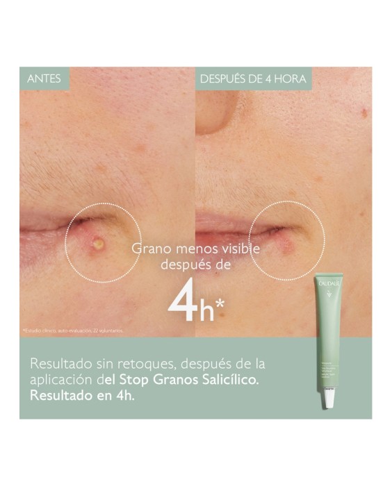 Stop Granos Salicílico Vinopure 15 ml Caudalie
