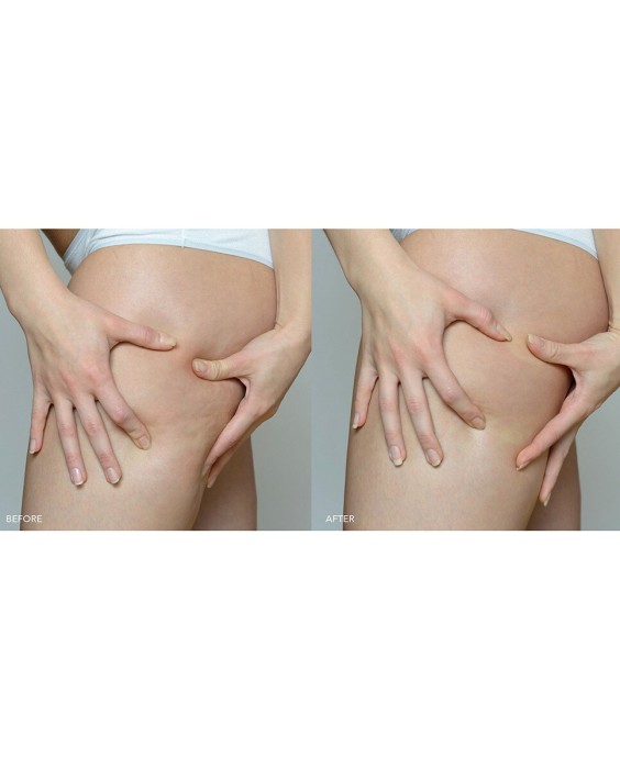 SUPERCHARGED™ Sérum Corporal Reafirmante FOREO