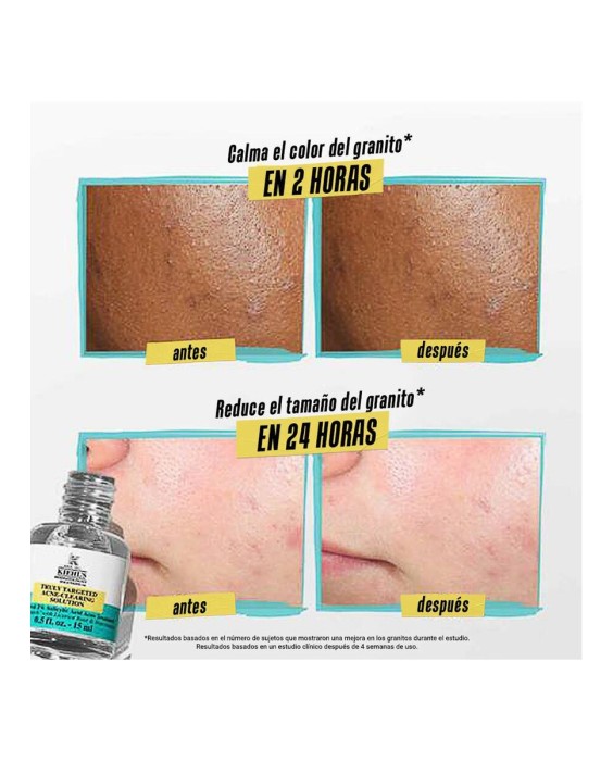 Parche invisible líquido Truly Targeted Acne-Clearing Pimple Patch Dermatologist Solutions 15 ml Kiehl's