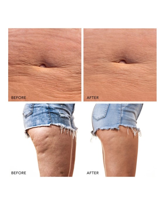 BEAR™ 2 body Dispositivo corporal de microcorrientes Evergreen FOREO