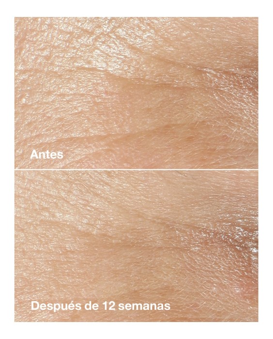 Crema Hidratante Antiarrugas Wrinkle Correcting Cream Smart Clinical Repair Todo tipo de piel 50 ml Clinique