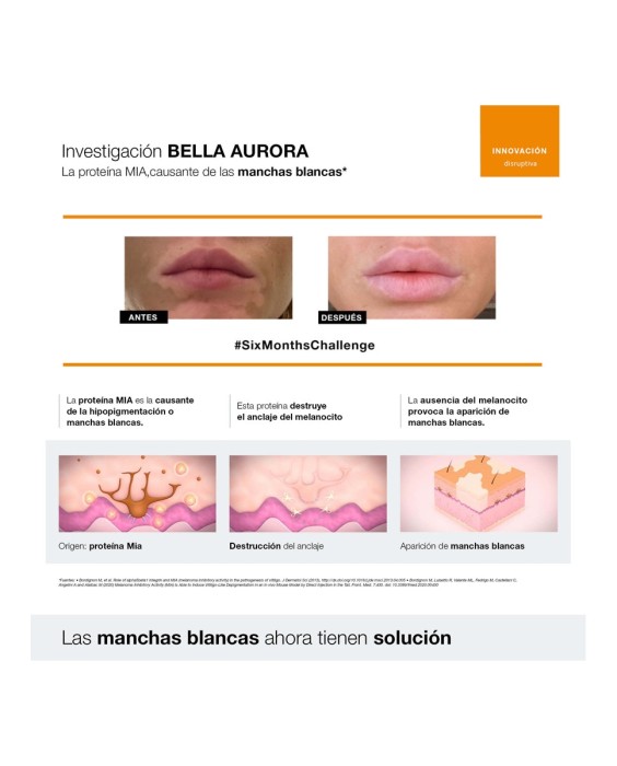 Crema Repigment12 75 ml Bella Aurora