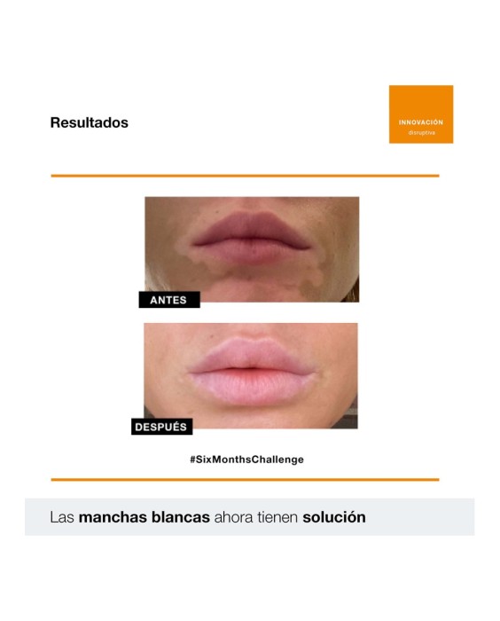 Crema Repigment12 75 ml Bella Aurora