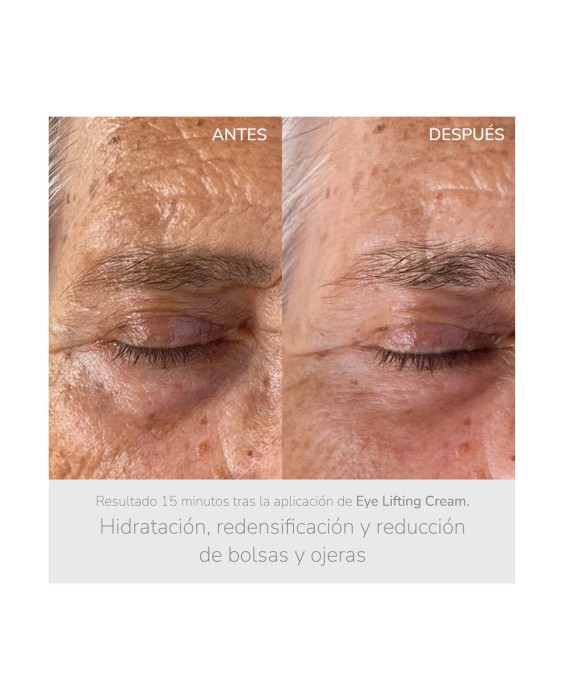 Contorno de ojos reafirmante Eye Lifting Cream 15ml NIEVES by Nieves Álvarez