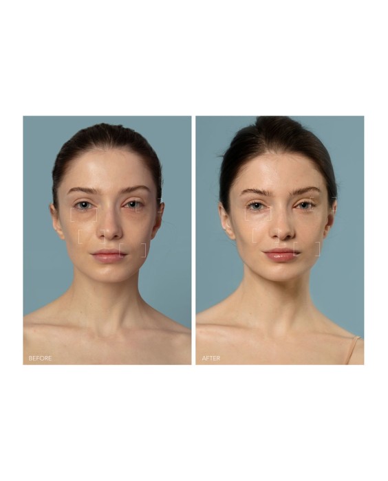 UFO™ 3 - Dispositivo de hidratación facial profunda 5 en 1 FOREO