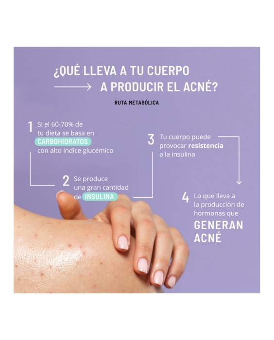 Gel Azelaic Active Body Treatment 100 ml Freshly Cosmetics