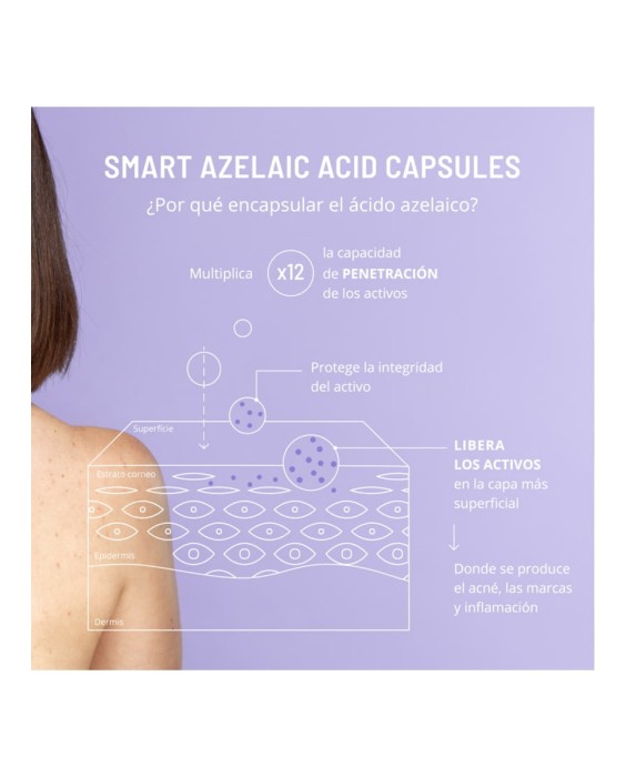 Gel Azelaic Active Body Treatment 100 ml Freshly Cosmetics