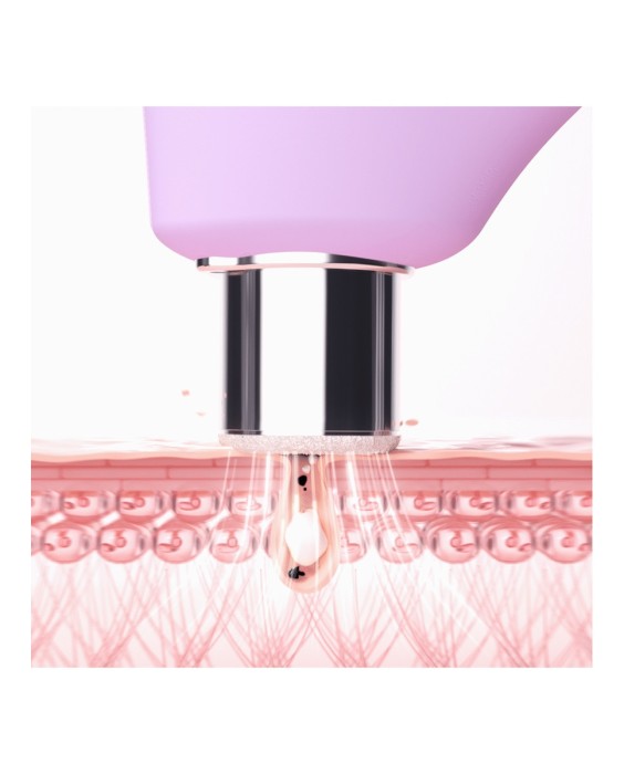 KIWI™ derma - Microdermoabrasión con diamantes Adamas y  dispositivo de aspiración de poros FOREO