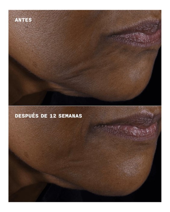 Crema hidratante Smart Clinical Repair Firmeza + Lifting Rostro/Cuello 50 ml  Clinique